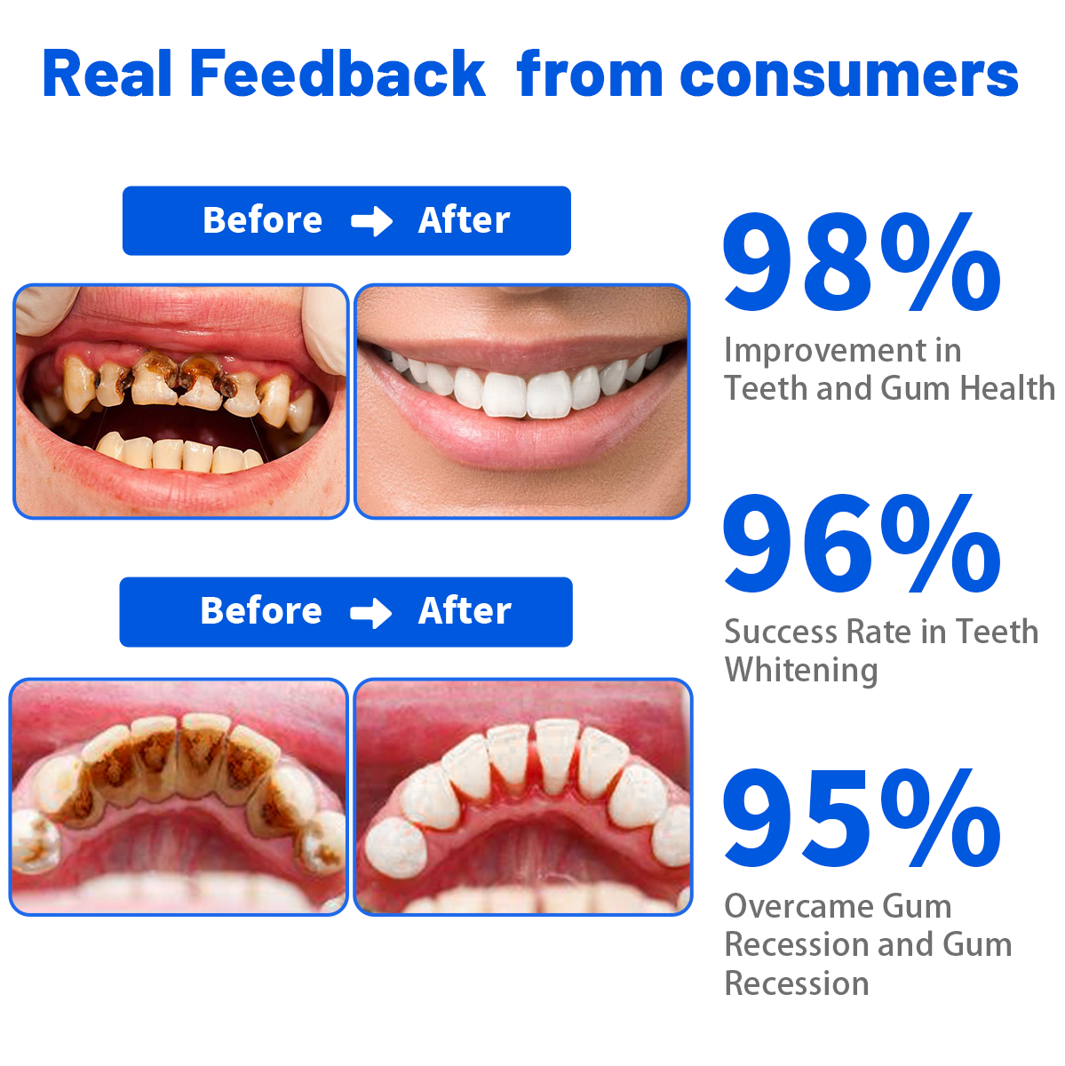 Seurico™ SmartSmile Bee Venom Whitening & Repair Toothpaste